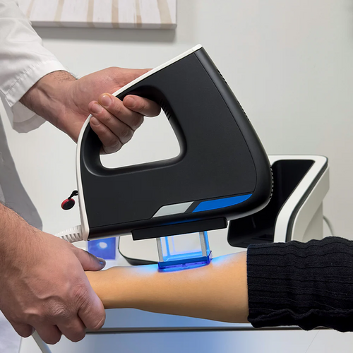 Technospa ExciLight - Excimer System