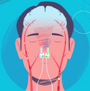 Vielight Intranasal Light Therapy Device, Supports Cognitive Function, Immunity, and Systemic Wellbeing
