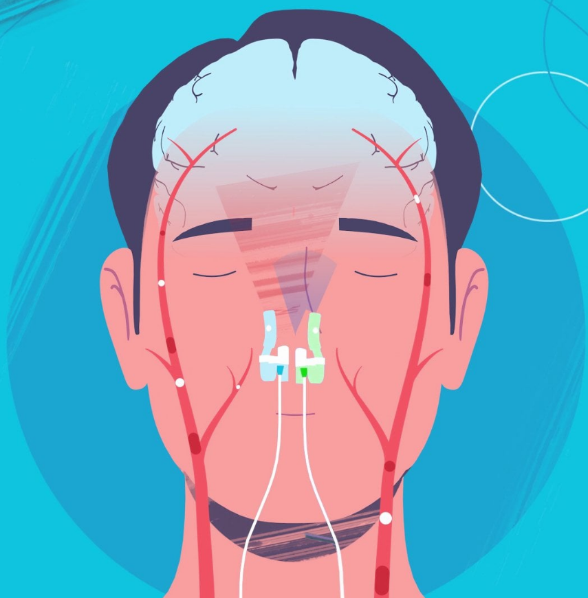 Vielight Intranasal Light Therapy Device, Supports Cognitive Function, Immunity, and Systemic Wellbeing