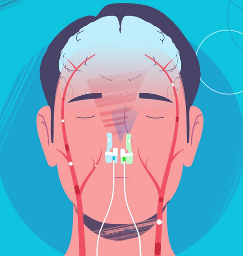 Vielight MIP Series, Multimodal Intranasal Light Therapy for Brain and Body Wellness